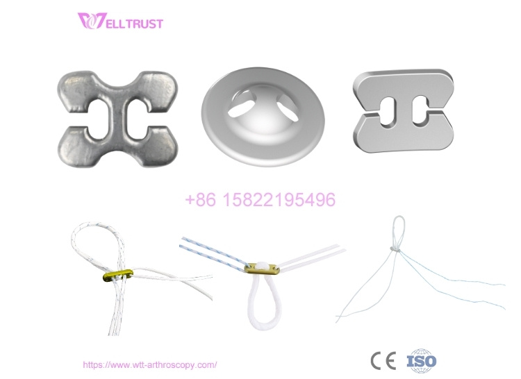 endobutton