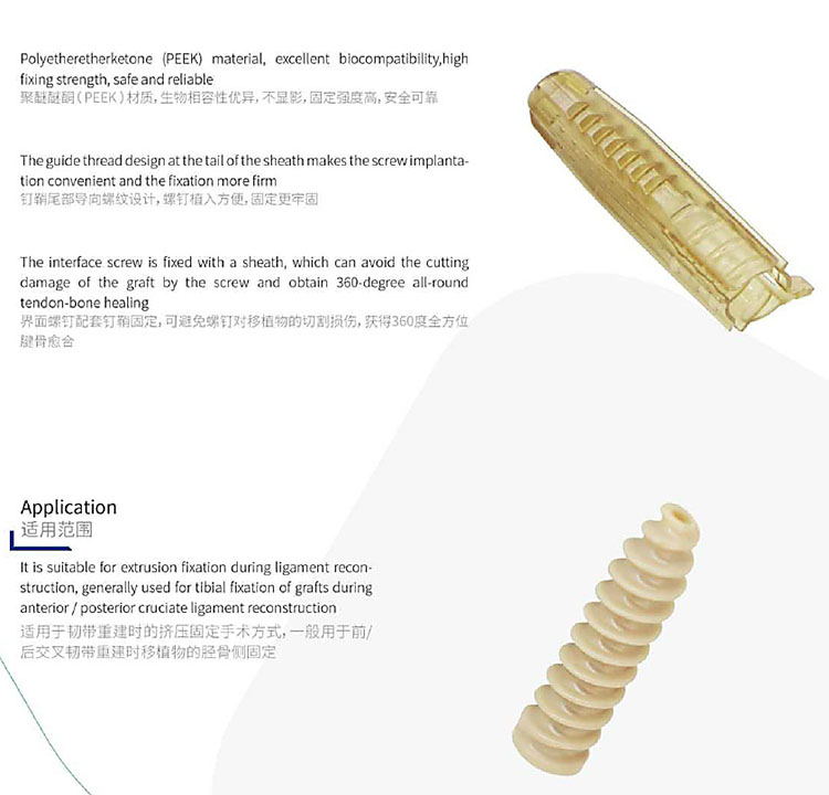 interference screw