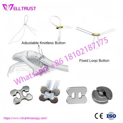 Adjustable Loop Button